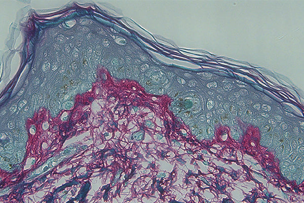 Collagen is a protein that gives firmness to the skin.