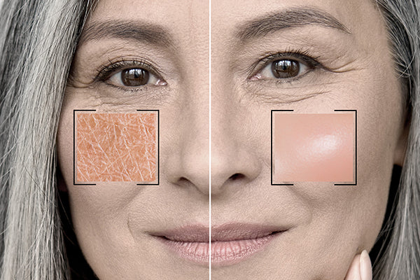 Combination skin combines characteristics of oily and dry skin