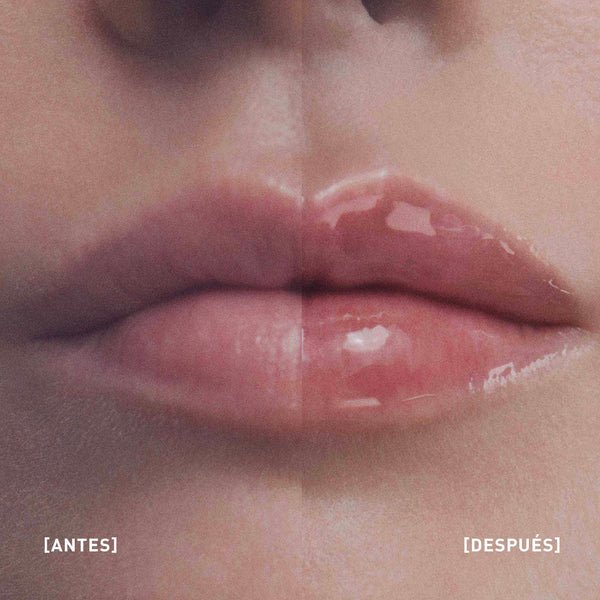 HYALU-FILLER LIPS