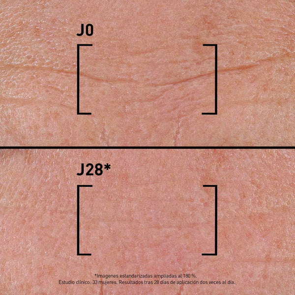 TIME-FILLER INTENSIVE 5XP